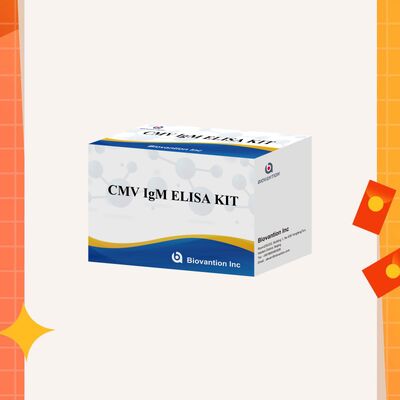 96T CMV ELISA Test Kit dengan Deteksi Colorimetric dan Metode Sandwich untuk Antibodi Sitomegalovirus
