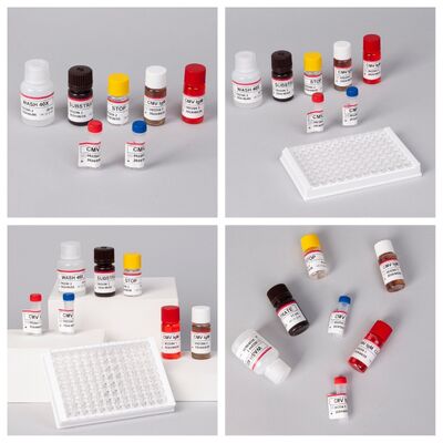 96T CMV ELISA Test Kit dengan Deteksi Colorimetric dan Metode Sandwich untuk Antibodi Sitomegalovirus