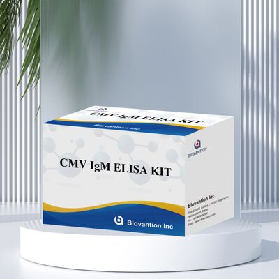 96T CMV ELISA Test Kit dengan Deteksi Colorimetric dan Metode Sandwich untuk Antibodi Sitomegalovirus