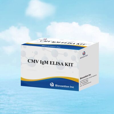 96T CMV ELISA Test Kit dengan Deteksi Colorimetric dan Metode Sandwich untuk Antibodi Sitomegalovirus