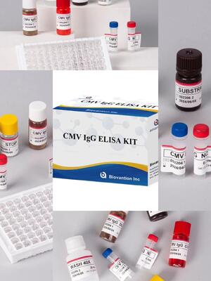 Laboratorium atau Rumah Sakit High Accuracy CMV IgG Elisa Test Kit