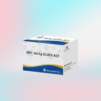 Kit Tes HIV ELISA Sensitivitas Tinggi untuk Pemeriksaan Darah dengan 96 Tes dan Sertifikat CE