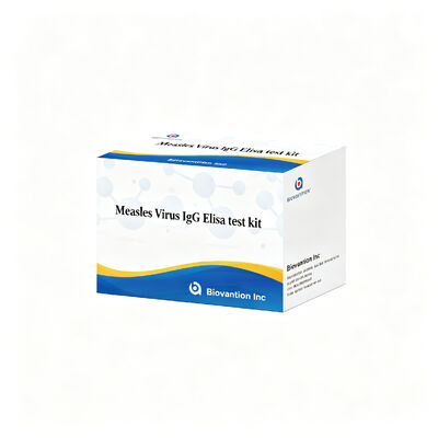 Virus campak IgG ELISA Test Kit Spesifisitas Sensitivitas Tinggi