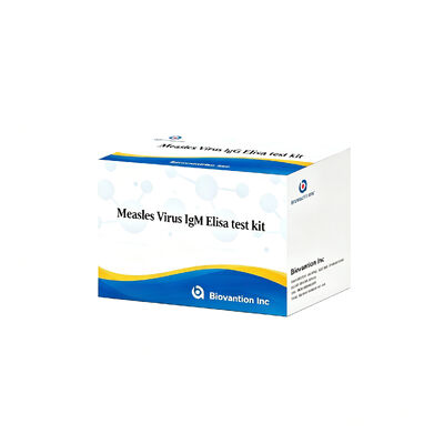 Virus campak IgM ELISA Test Kit 96T Deteksi awal infeksi akut