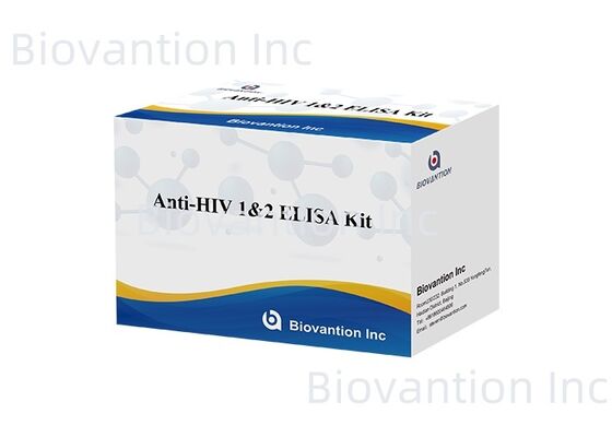 HIV 1/2 ELISA Test Kit 96T Deteksi antibodi Virus Kekurangan Kekebalan Manusia